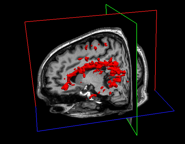 Visualization of an MRI