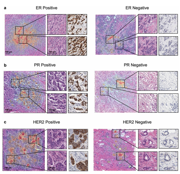 Examples of saliency maps