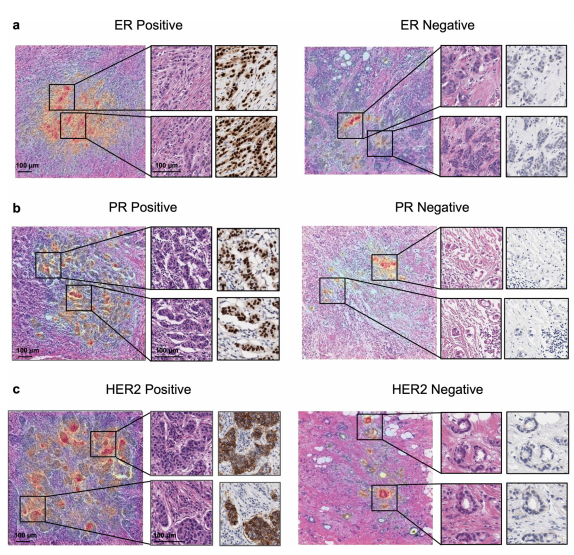 Examples of saliency maps 