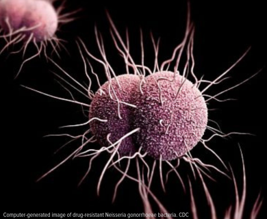 Computer-generated image of drug-resistant Neisseria gonorrhoeae bacteria.