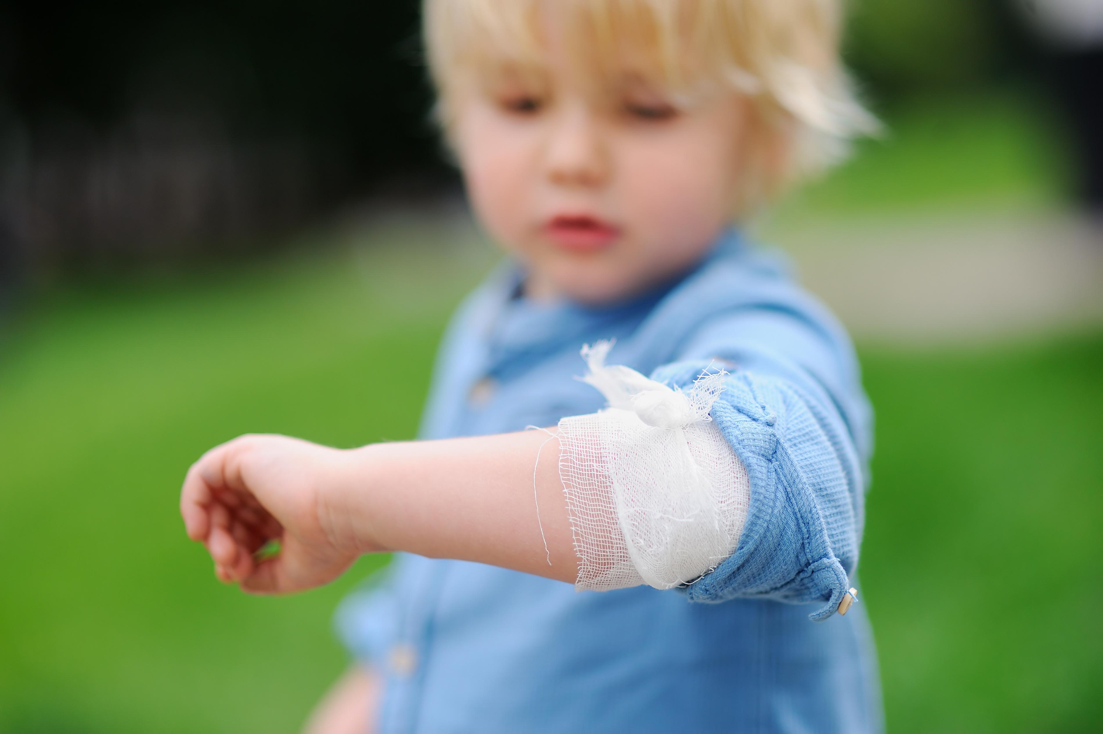 Child with injury on elbow